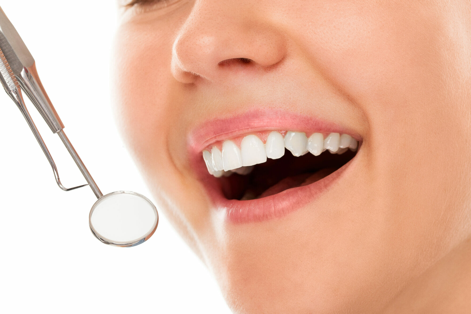 Tooth Whitening at Greenwood Dental Smiles