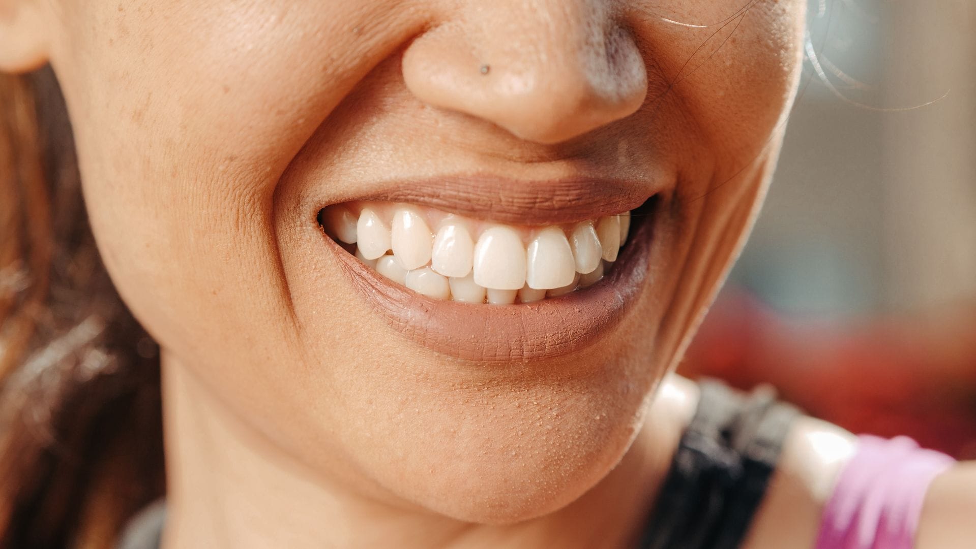 A close-up of a woman's smile Greenwood Dental Smiles Clinical Team Photo