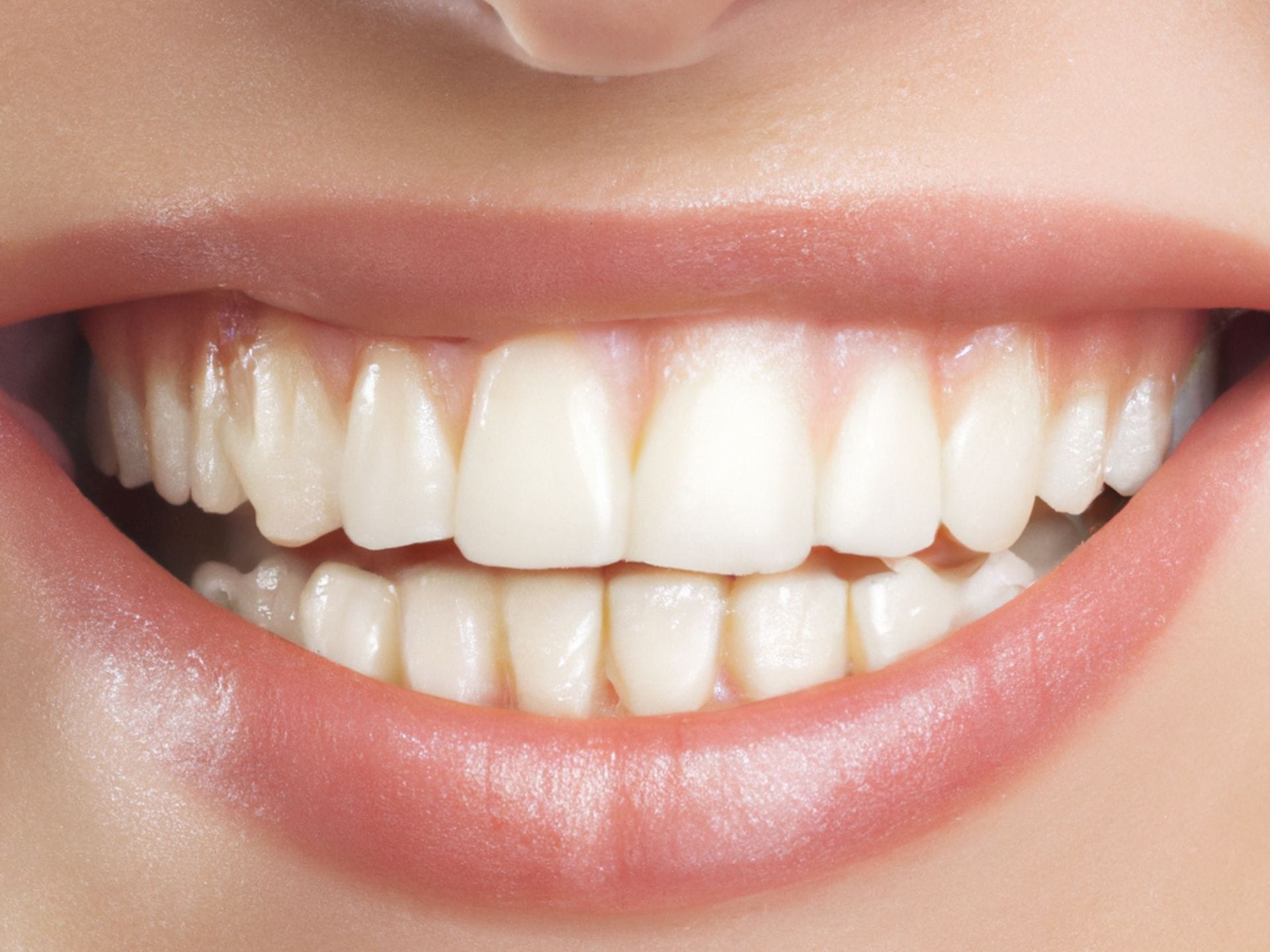 White teeth